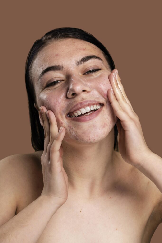 Skin Care for Women